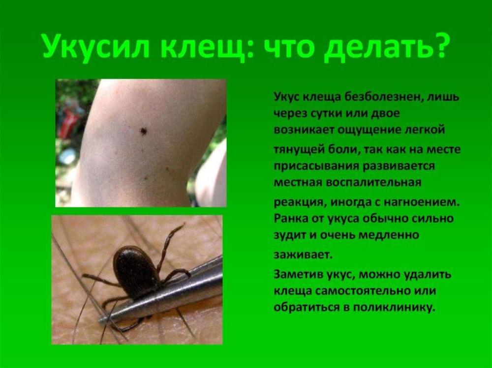Укус клещей